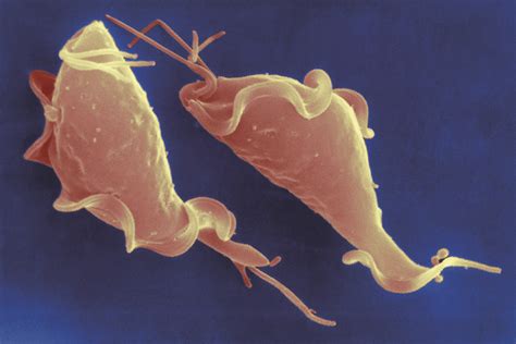 Trichomonas Vaginalis Discharge PDF) Vaginal Discharge In A Young