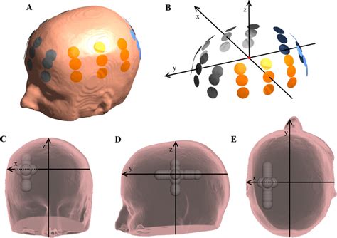 Visualization of electrode placement, coordinate system and tumor ...