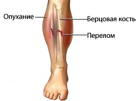 Большеберцовая кость: анатомия и строение, расположение, метафиз и ...