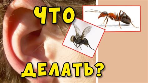 КАК УБРАТЬ серную ПРОБКУ или МУРАВЬЯ из УХА. Простейшее приспособление ...