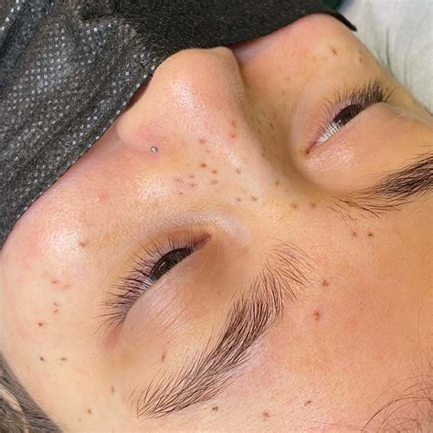 Semi-Permanent Freckle Tattoos: The Ultimate Guide