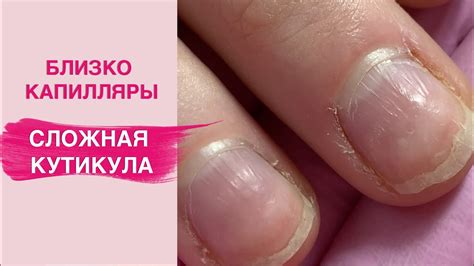 Сложная кутикула | Боязнь каждого мастера маникюра - YouTube