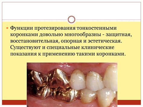 Стоматологияда қолданылатын титан қорытпалары - презентация онлайн