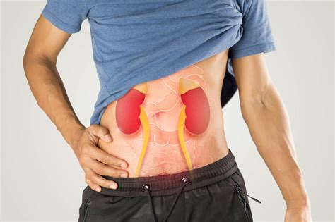 Cólica Renal O Que Fazer Para Aliviar A Dor - Cólica renal: como aliviar a dor e evitar complicações durante a crise
