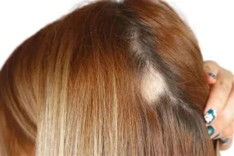 Dermastamp Hair: 7 Proven Ways It Boosts Growth and Fights Hair Loss ...