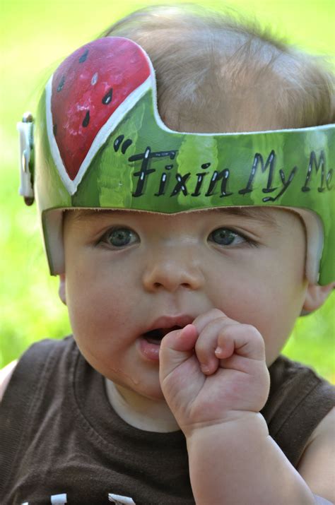Pin by Leigh Gibson on Cranial Bands/Helmets | Baby helmet, Doc band