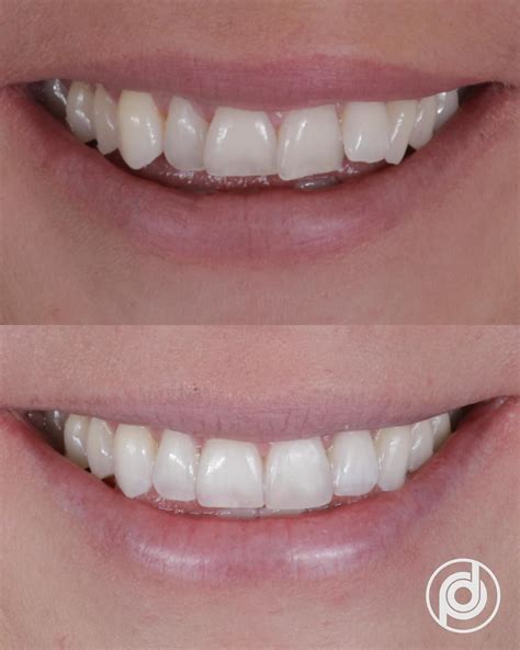 Precision Dentistry of Williamsburg | Williamsburg VA