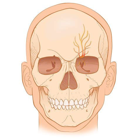 Supraorbital Neuralgia Stock Art