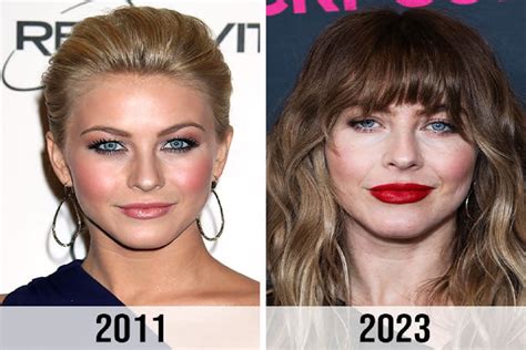 Julianne Hough Wikifeet: Before & After Photos - 2dnky5a