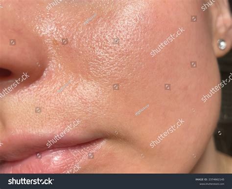 thousand pore detail royalty  images stock  pictures