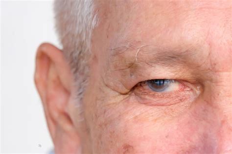 After Cataract Surgery: Dos and Don’ts | Austin & Dripping Springs