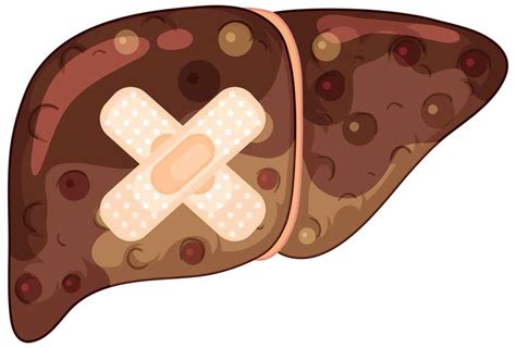liver cleanse heres  experts