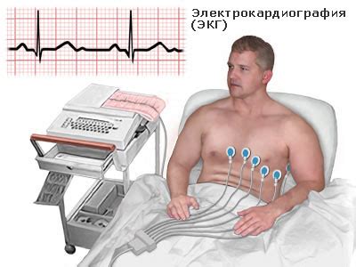 Электрокардиография. ЭКГ.