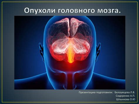 Опухоли головного мозга - презентация онлайн