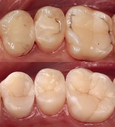 global clinical case contest  dentsply sirona honours