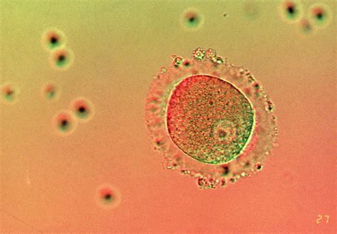 Lm Of Human Zygote After In-vitro Fertilisation Photograph by Cc Studio ...