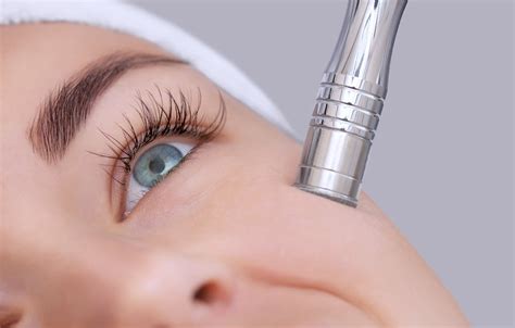 Microdermabrasion - Novuskin