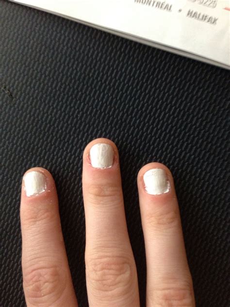 How To Fix Short Bitten Nails With Gel at Edward Macmillan blog