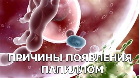 Причины появления папиллом - YouTube