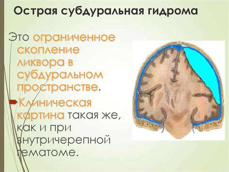 Черепно–мозговая травма - презентация онлайн