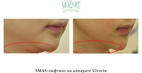 Косметологія - фото до і після процедур в Одесі і Україні