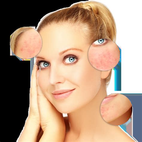 reasons  face  red resources valley dermatology