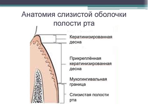 Методы френуло- и вестибулопластики - презентация онлайн