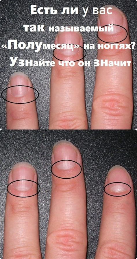 Рецепты | Health healthy, Herbal medicine, Nail polish