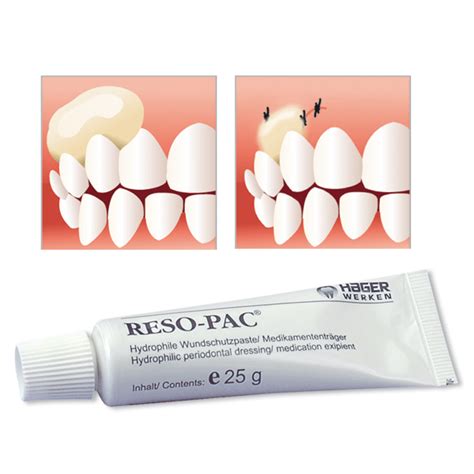 Купить Hager & Werken Reso-Pac Саморассасывающаяся повязка для изоляции ...