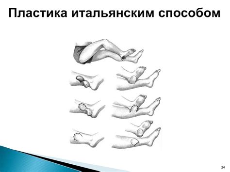 Дерматопластика - презентация онлайн