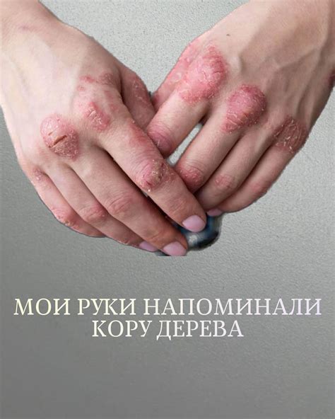 ОБУЧЕНИЕ МАНИКЮРУ | ГЕЛЬ | УКРЕПЛЕНИЕ ГЕЛЕМ | ОНЛАЙН | МОСКВА | Делать ...