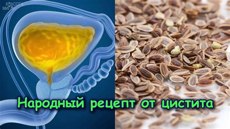 НАРОДНЫЙ РЕЦЕПТ ОТ ЦИСТИТА - YouTube