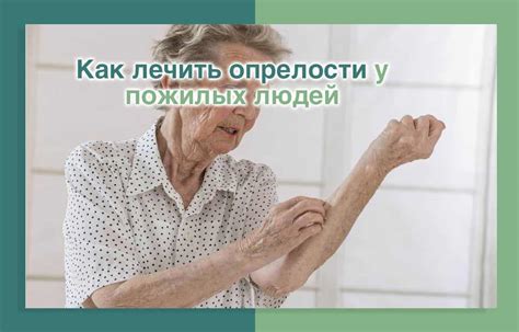 Как лечить опрелости у пожилых людей | Дом престарелых "Счастливая ...