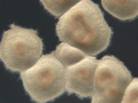 ESA - Streptomyces colony at Leiden University