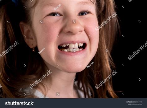 Little Girl Shows Crooked Teeth On Stock Photo 1724857417 | Shutterstock
