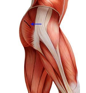 Mini-Posterior Hip Replacement Newport | Hip Pain Providence, Tiverton