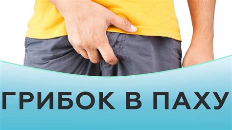 Грибок в паху - YouTube