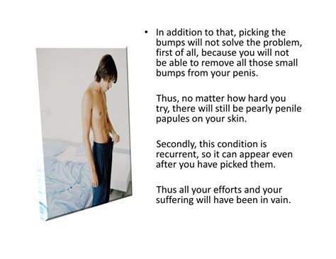 PPT - Pearly Whites, Anaesthetic Cream For Ppp, Pearly Penile Papules