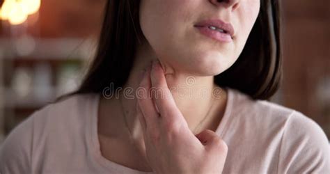 thyroid neck disease stock photo image  neck girl