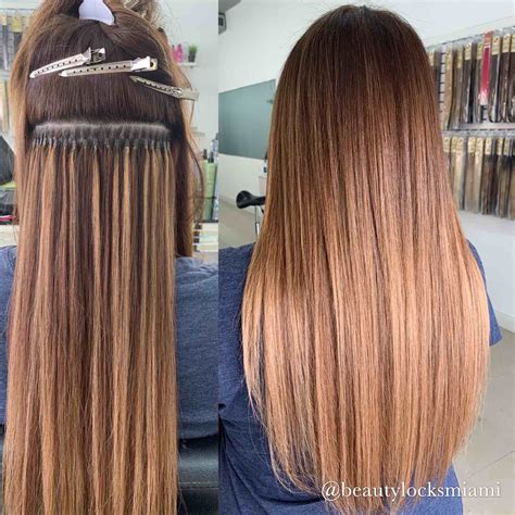 monilethrix beaded hair 3