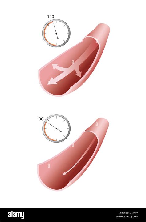 ARTERIAL PRESSURE, DRAWING Stock Photo - Alamy