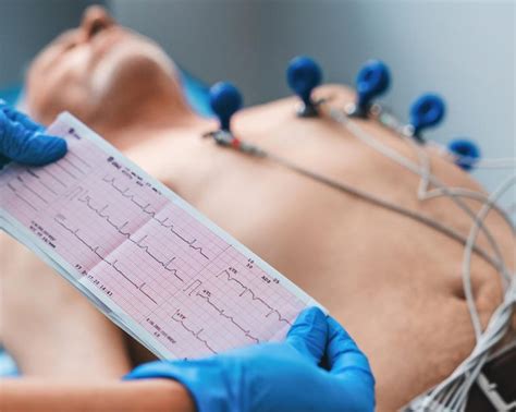ecg test price purpose procedure types  india