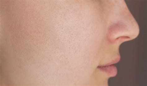 scar treatment  skin secrets kochi