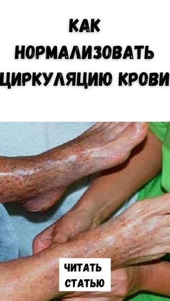 Как нормализовать циркуляцию крови в 2024 г | Здоровье ног, Товары для ...