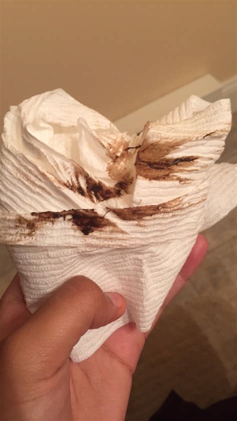 TMI ! Brown Stringy Discharge - Glow Community