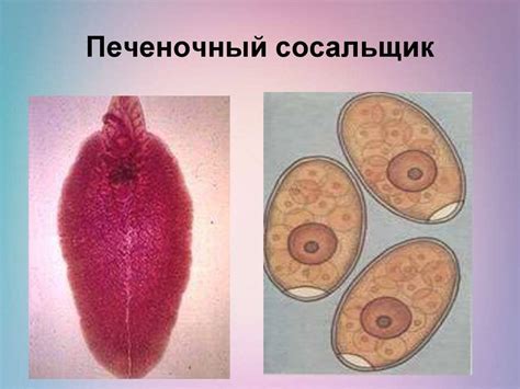 Печеночный сосальщик: симптомы заражения, профилактика и способы ...