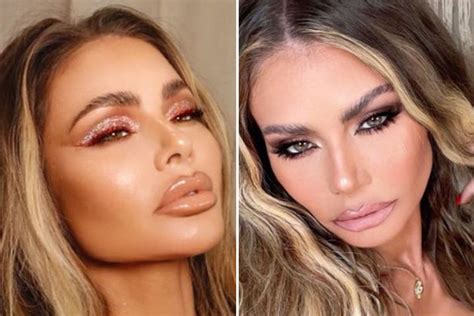 Towie's Chloe Sims reveals she's dissolved her lip fillers for a 'more