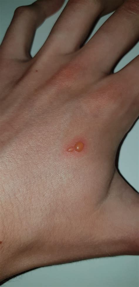 Any help identifying this? Its not from a burn and doesn't itch or hurt