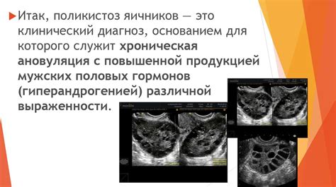 Поликистоз яичников - презентация онлайн