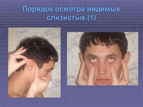 Общий осмотр больного. Антропометрические исследования - презентация онлайн